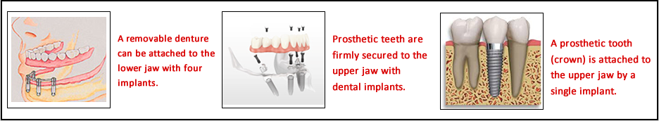 Sakuki dental hospital in Sri lanka